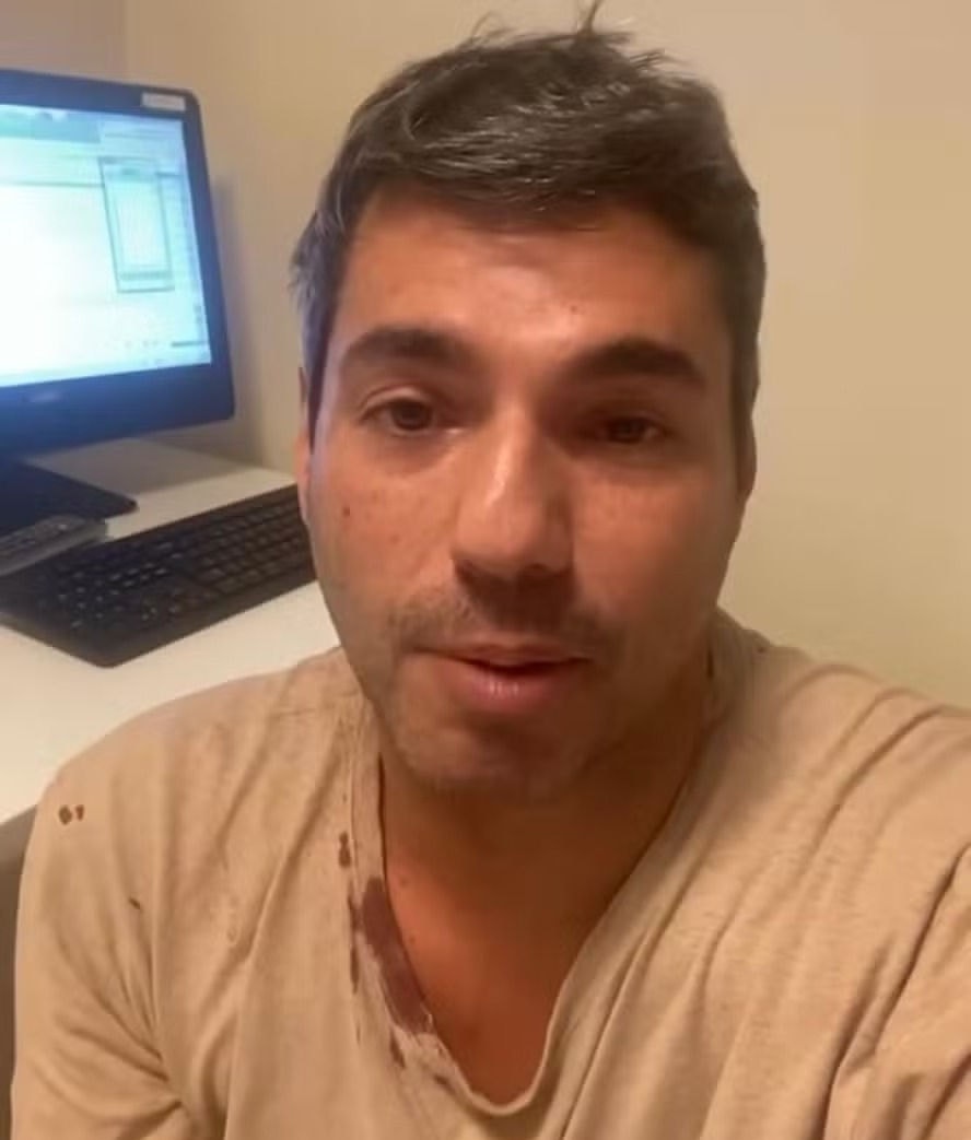Felipe Bronze falou sobre o assalto que sofreu em vídeos compartilhados no Instagram