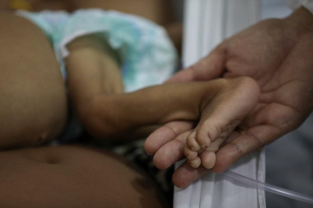 Uma criança Yanomami desnutrida recebe cuidados médicos no Hospital Infantil Santo Antônio, em Boa Vista, Roraima