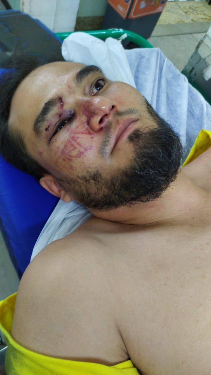 Violência policial