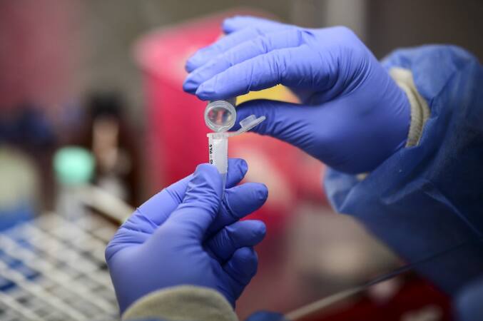 Testagem é fundamental para autoridades frearem casos simultâneos de Covid-19 e da Gripe Influenza, aponta especialista