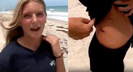 Jovem que lutou contra tubarão