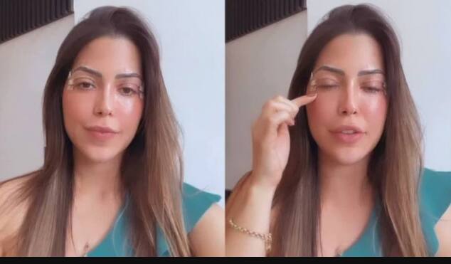 Laís Caldas faz cirurgia plástica nos olhos