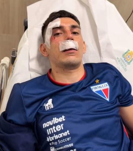 Escobar foi um dos jogadores do Fortaleza que se feriram em ataque ao ônibus da delegação