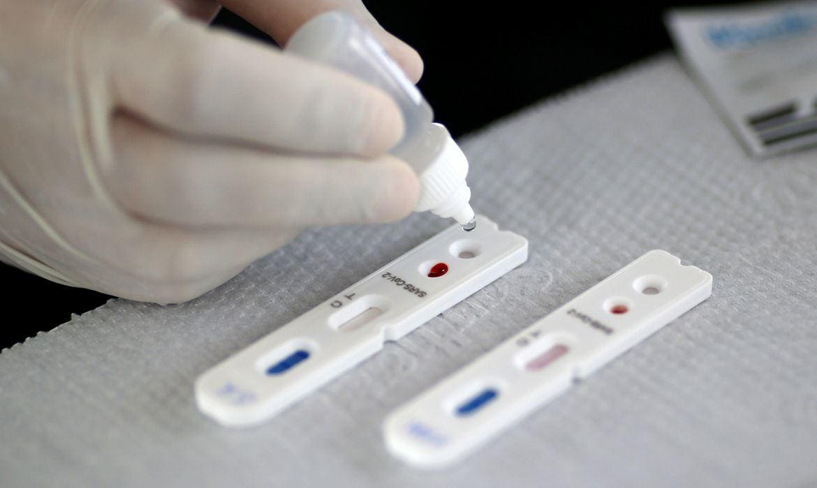 Vacina contra coronavírus vai ser testada