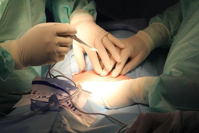 Imagem ilustrativa de cirurgia