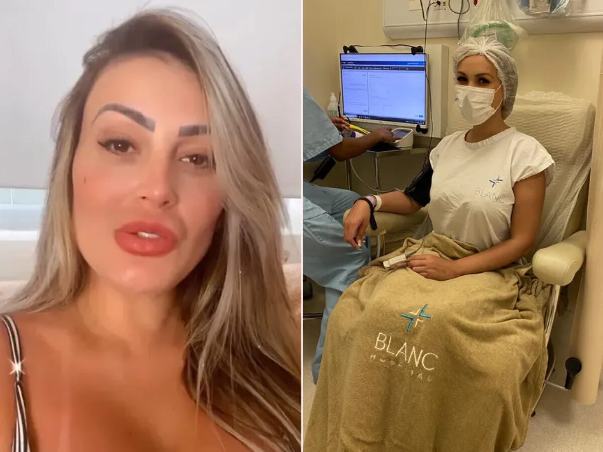 De retirada de costela à mudança de cor nos olhos; as cirurgias de Andressa Urach