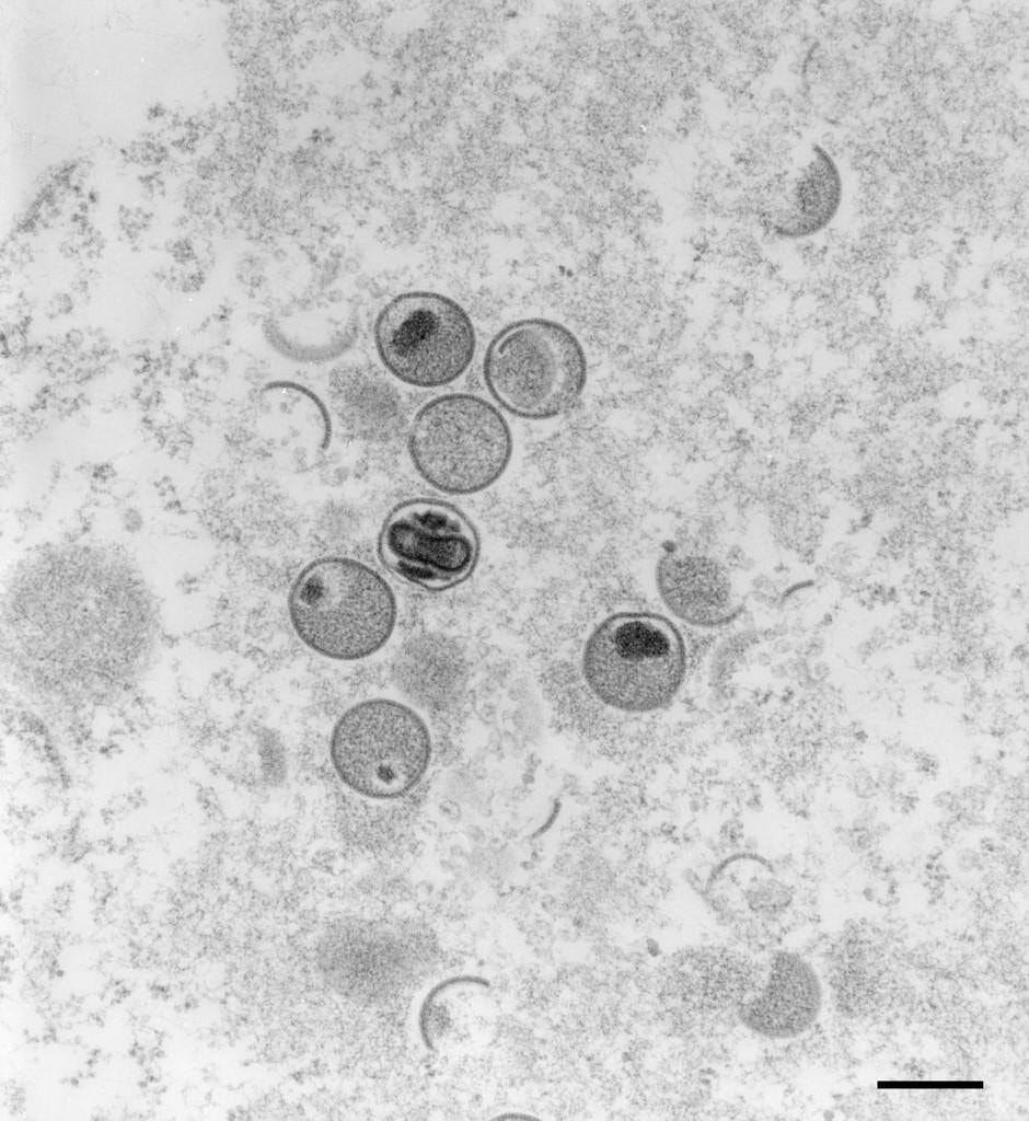 Imagem microscópica da varíola dos macacos em estudo no Instituto Koch, na Alemanha