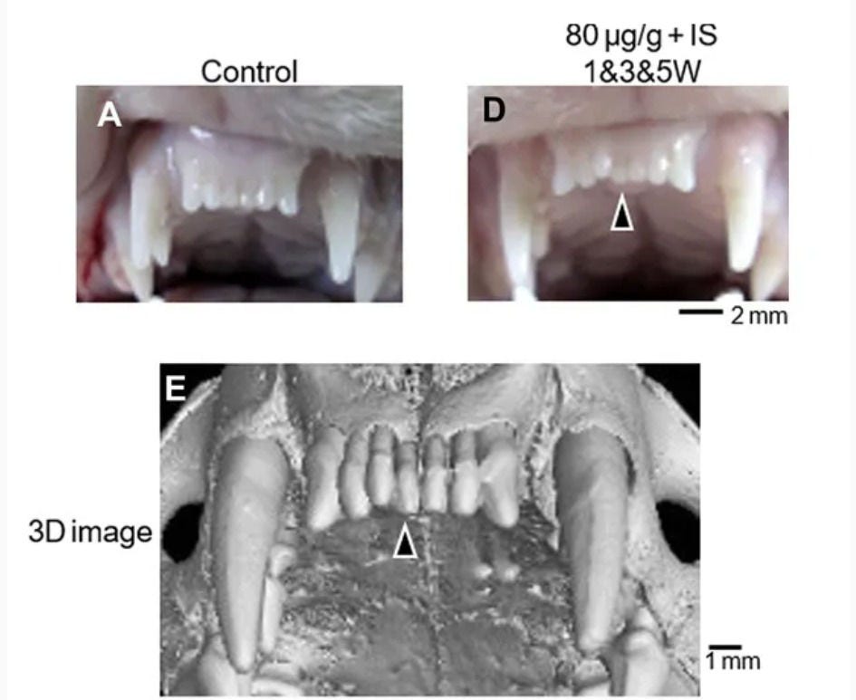 Remédio que faz dentes crescerem é esperança da ciência para resolver casos de doenças congênitas