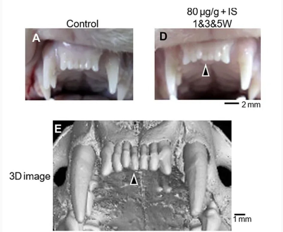 Remédio que faz dentes crescerem é esperança da ciência para resolver casos de doenças congênitas