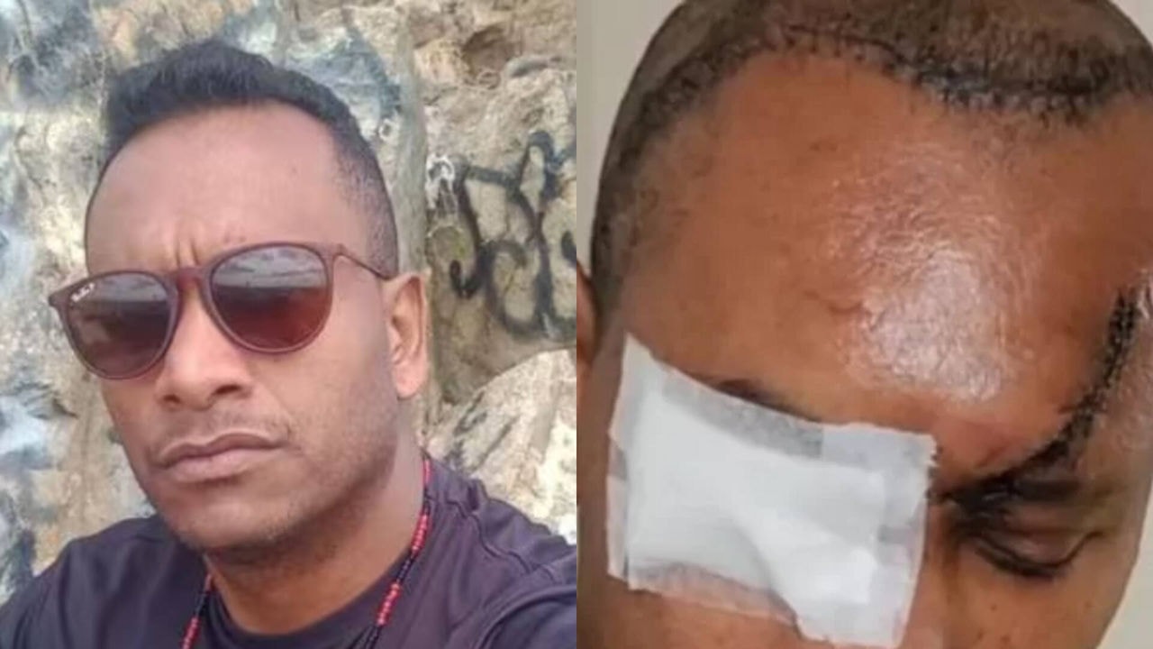 Bruno Adão vigilante