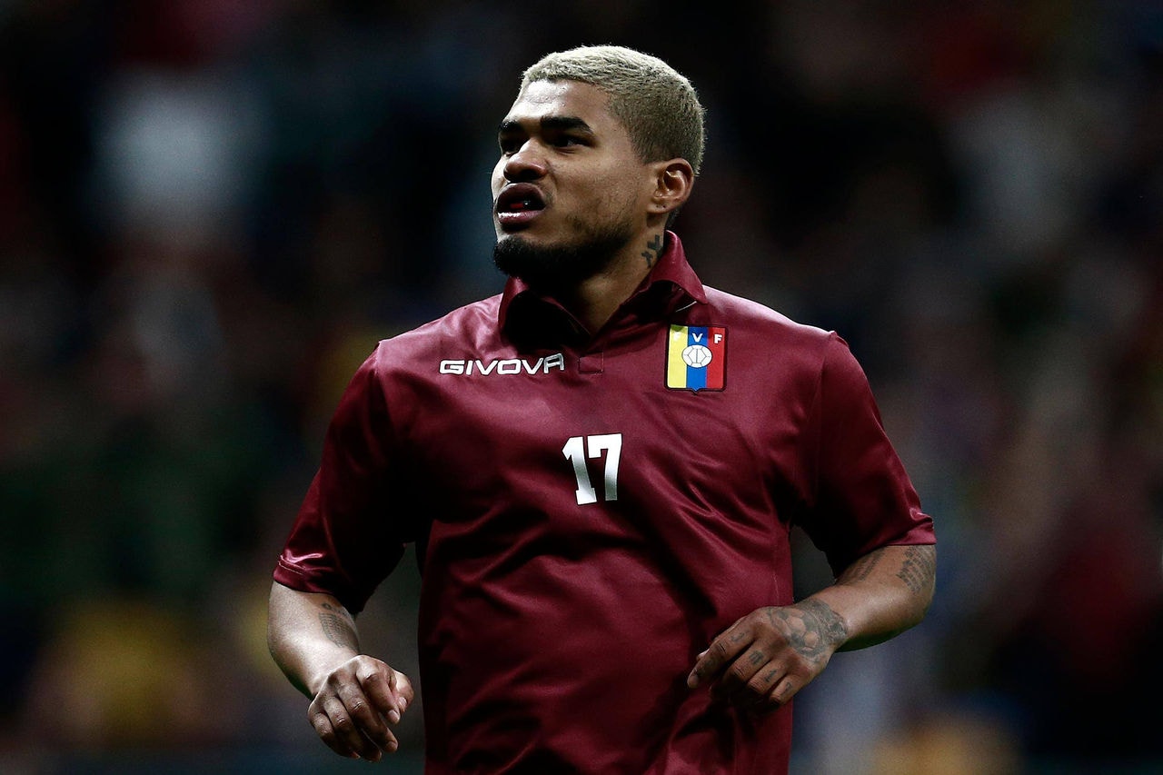 Jogadores venezuelanos se revoltam com camisa comprada em loja