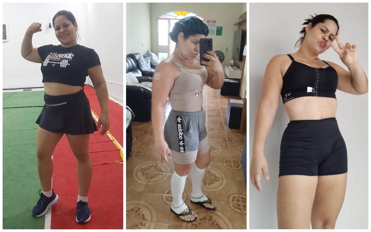 Raimoni fez três procedimentos na cidade mineira