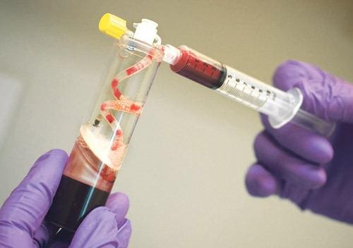 Plasma de sangue