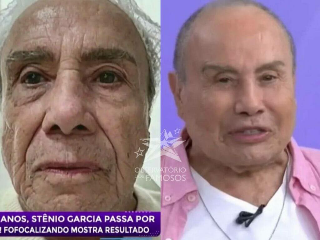Stênio Garcia se manifesta após críticas por harmonização facial aos 91 anos