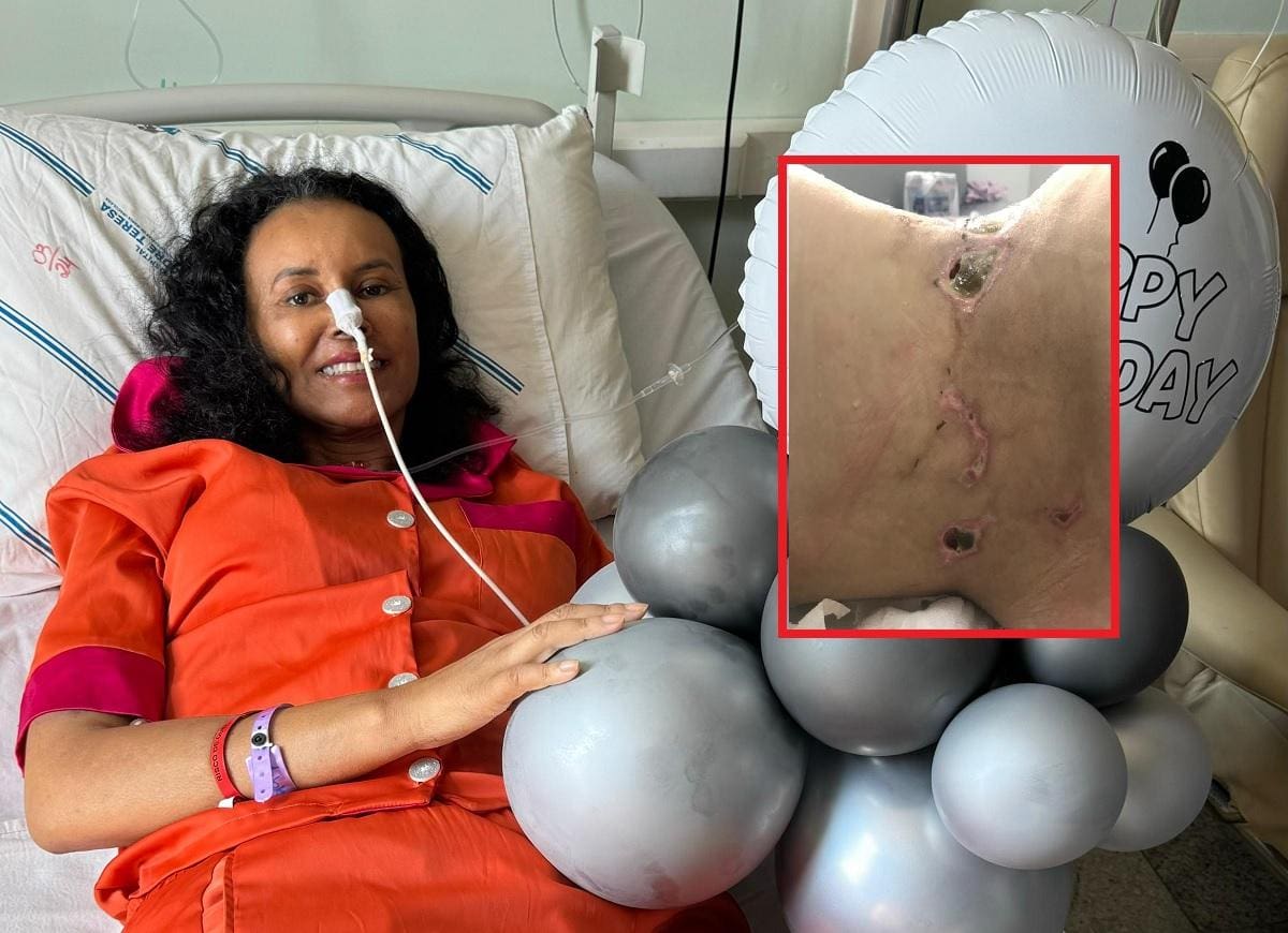 Foto mostra Norma comemorando os 59 anos no hospital onde acabou morrendo; no detalhe, ferimento necrosado de uma das pacientes que denunciaram o cirurgião
