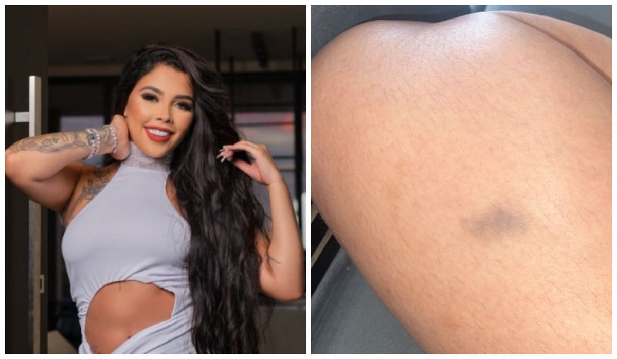 Marina Lino, de 22 anos, que tem mais de 80 mil seguidores nas redes sociais, foi atacada com uma faca por uma vizinha