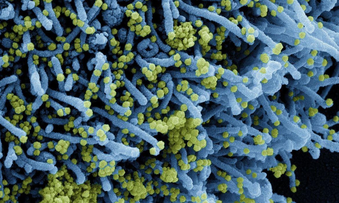 África do Sul: Descoberta nova variante do coronavírus com grande mutações