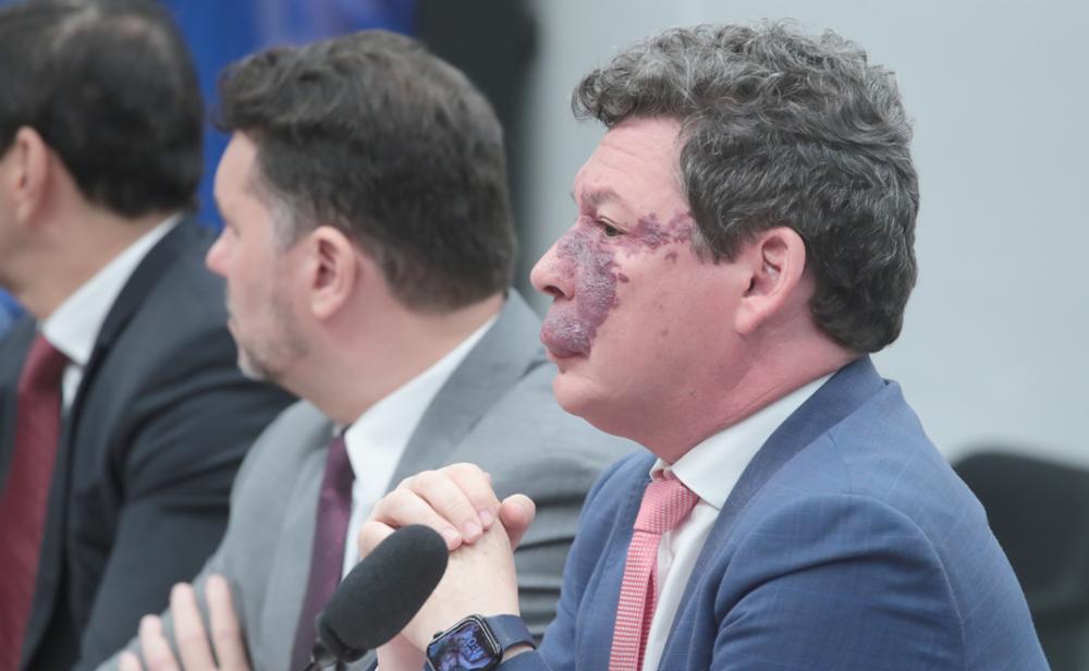 O deputado federal Reginaldo Lopes (PT-MG) acredita que o Colégio de Líderes ou o plenário da Câmara ainda possam chegar a um acordo e incluir as armas e munições no Imposto da Maldade 