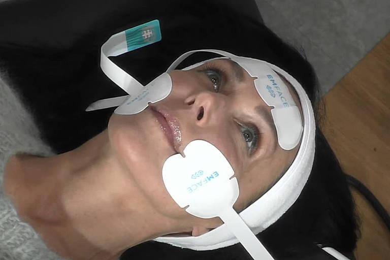 tratamento EmFace