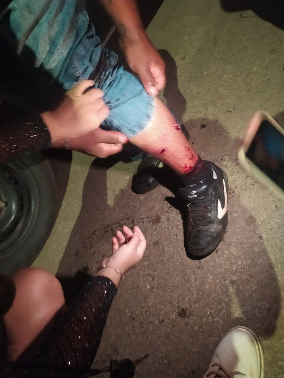 Foto mostra homem com ferimento de tiro na perna durante a confusão com a polícia