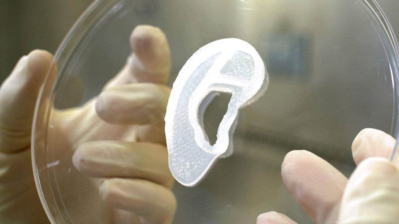 Impressora 3D consegue produzir orelha orgânica que depois é inserida em paciente