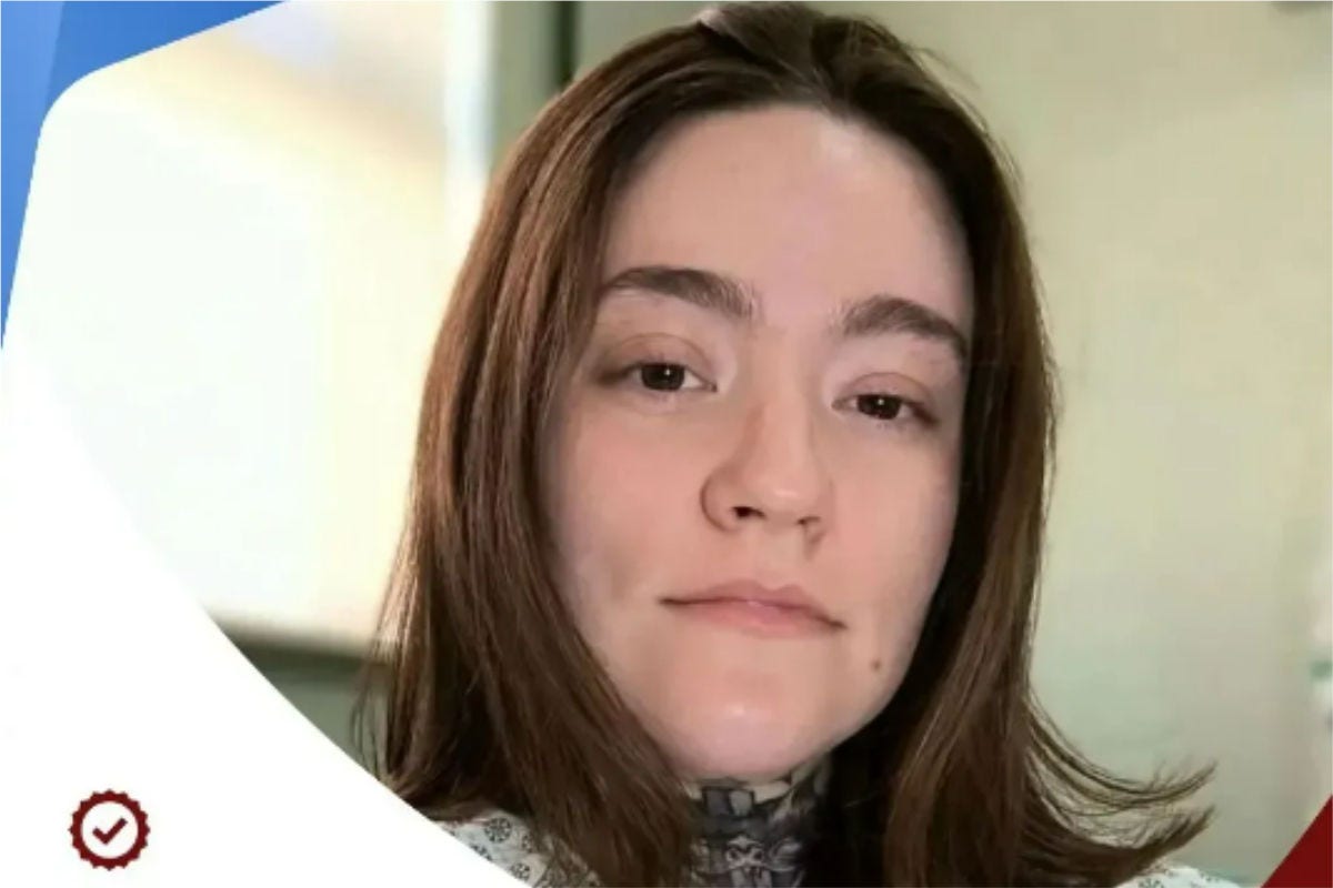 Carolina Arruda vive há 11 anos com neuralgia do trigêmeo