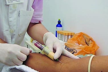 Hemogramas em excesso podem gerar uma anemia no paciente