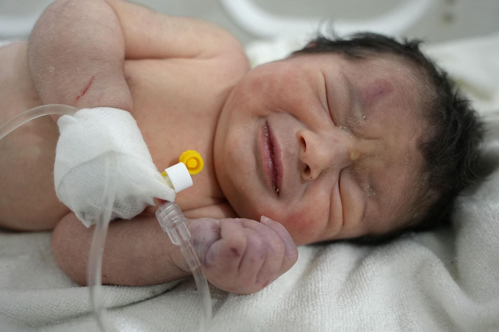 bebê encontrada com cordão umbilical após terremoto na Síria