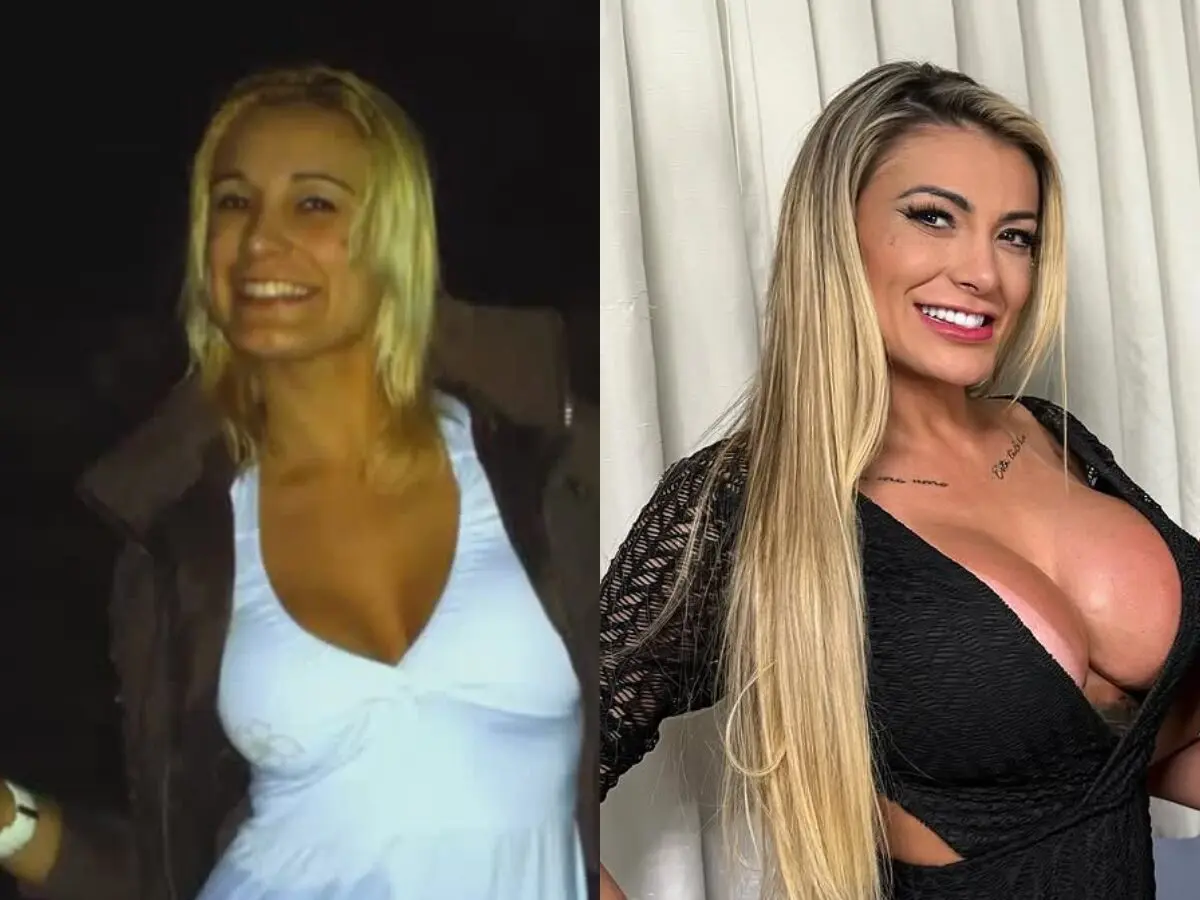 Antes e depois de Andressa Urach