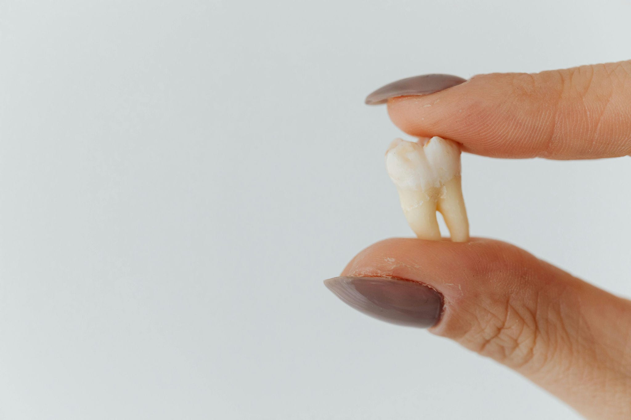O canino utilizado na cirurgia foi apelidado de "dente do olho" (Imagem ilustrativa)