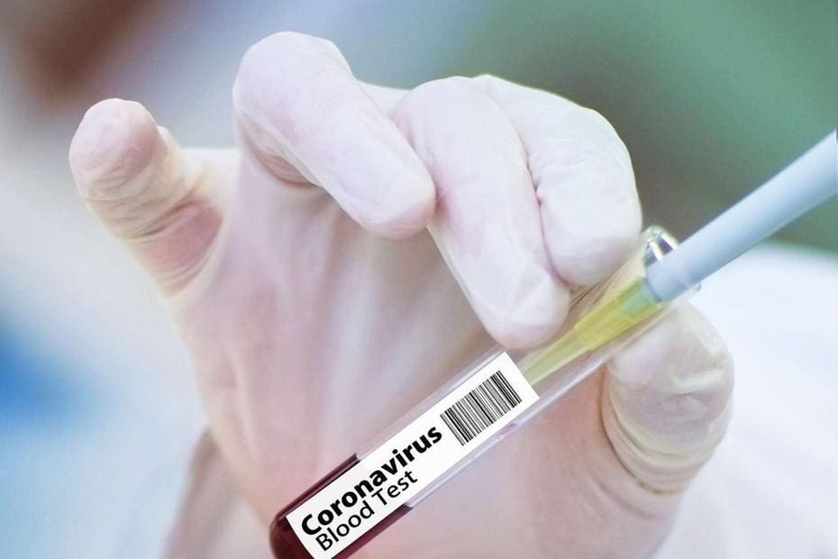 coronajpg