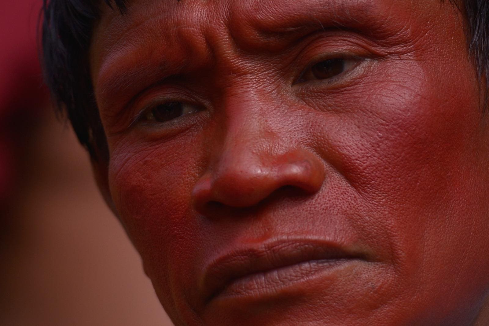 Dor Yanomami
