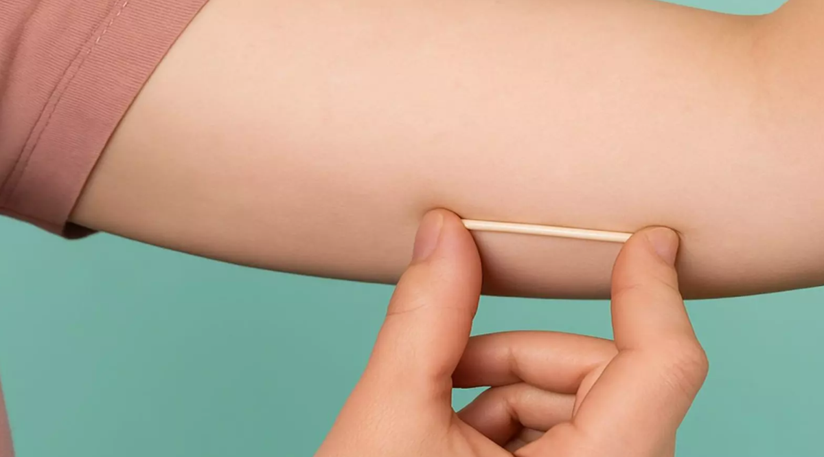 Implanon é considerado vantajoso em relação aos demais contraceptivos em razão da longa duração