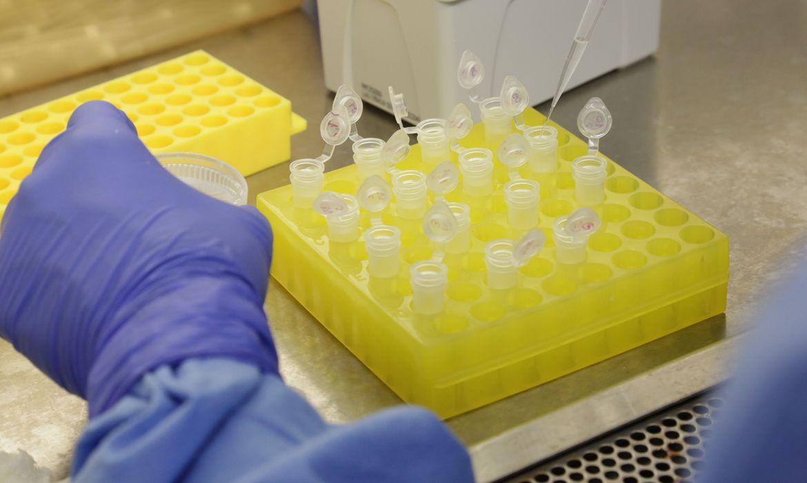 Diagnostico laboratorial de um suspeito com coronavírus