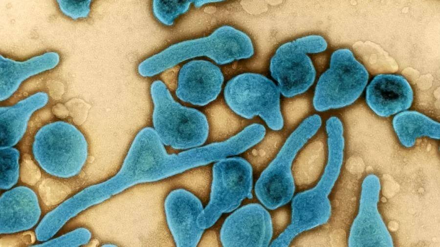 'Primo' do Ebola, Marburg é motivo de preocupação para OMS