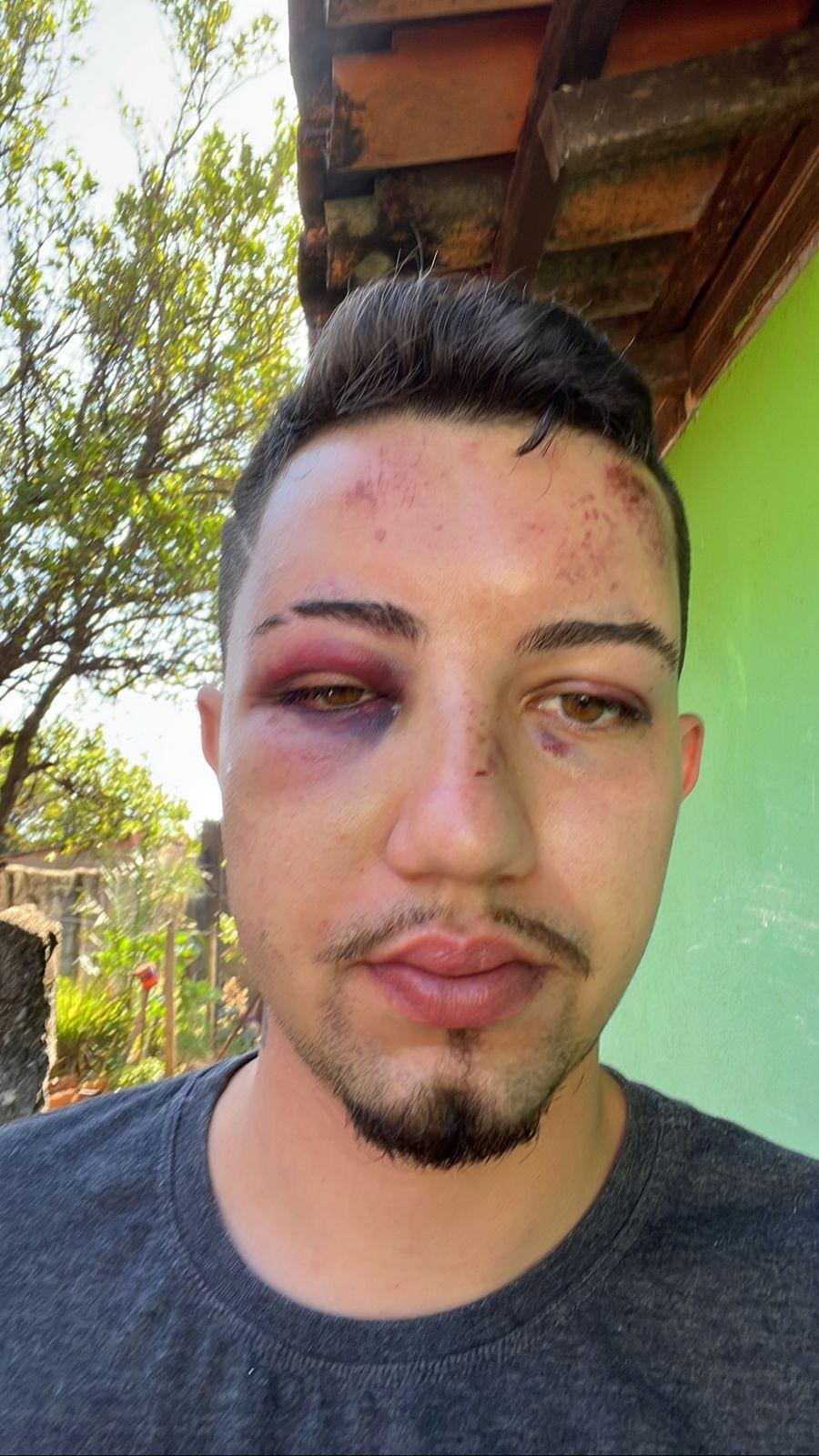 Marcos Gonçalves, agredido por policiais em Paineiras