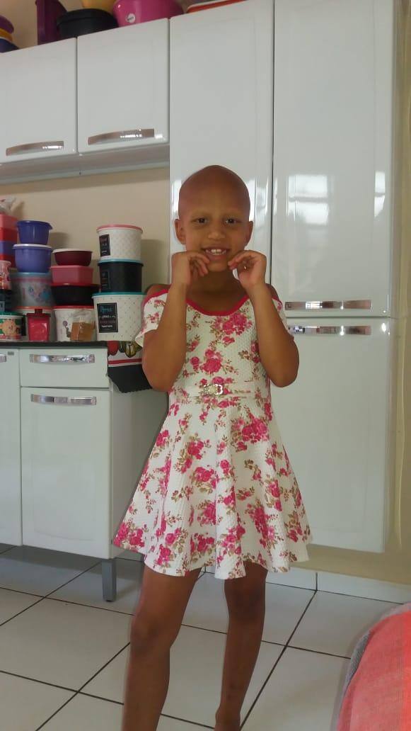 Bibi, de seis anos, sofre de alopecia