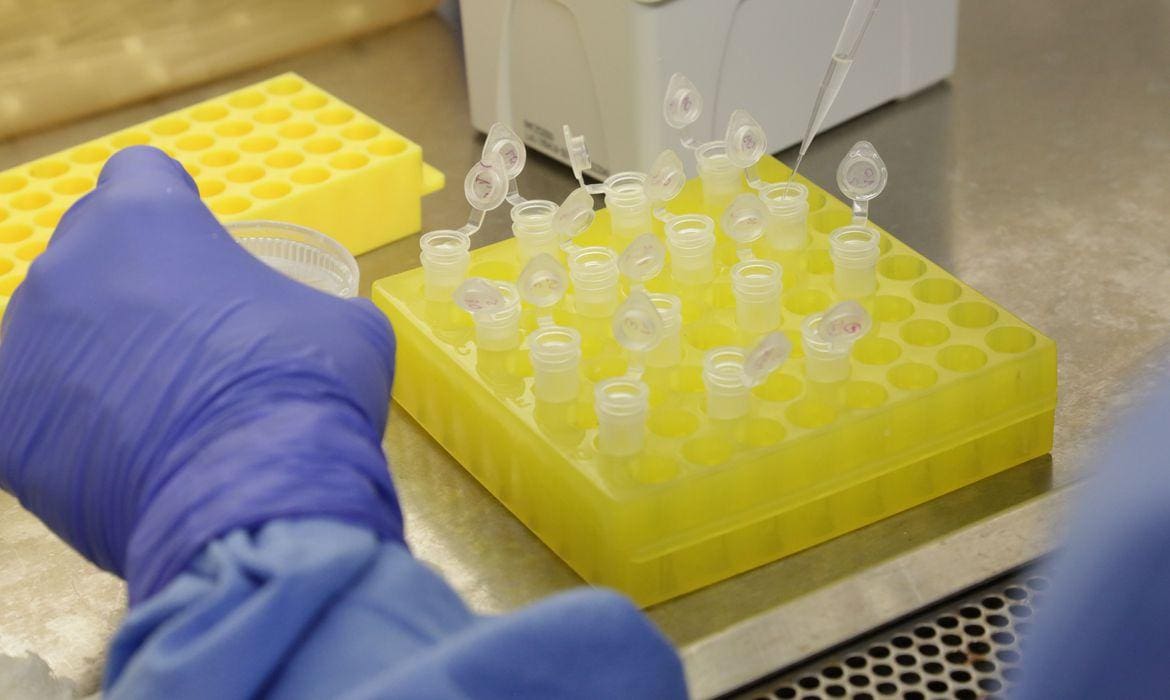 Uruguai consegue criar kits próprios para detectar o coronavírus