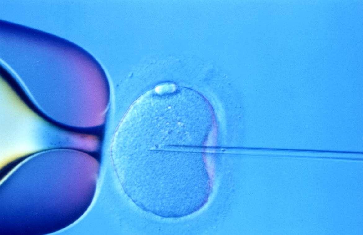 in vitro fecundação