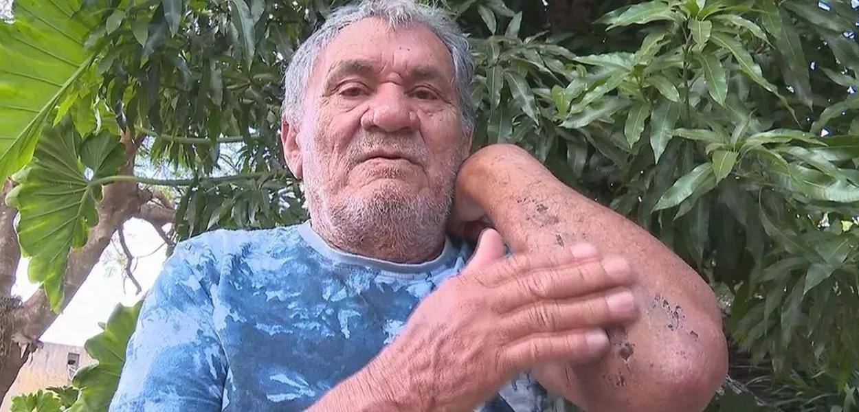 José Arteiro Ribeiro comeu insetos e bebeu urina para sobreviver após 8 dias perdido na mata
