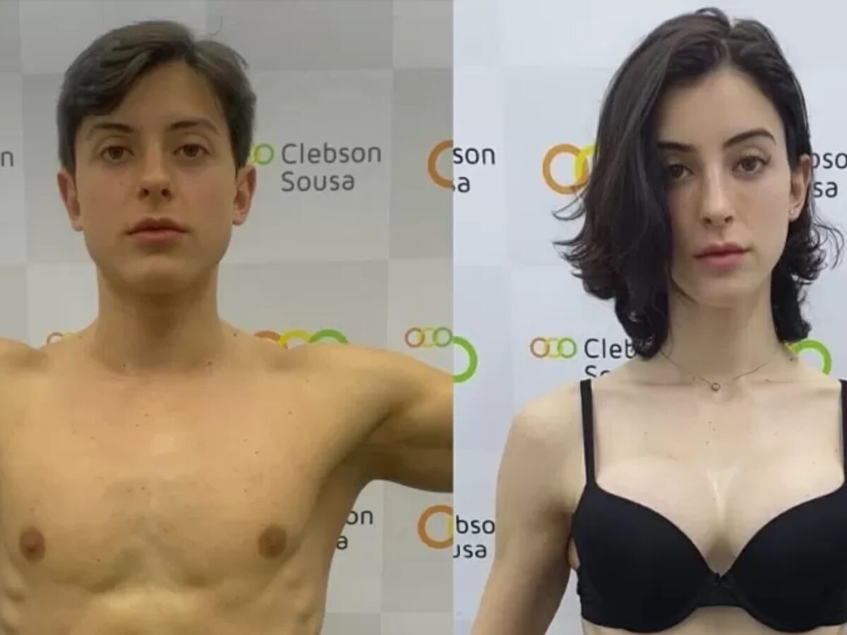 Bella Longuinho mostra antes e depois da transição de gênero