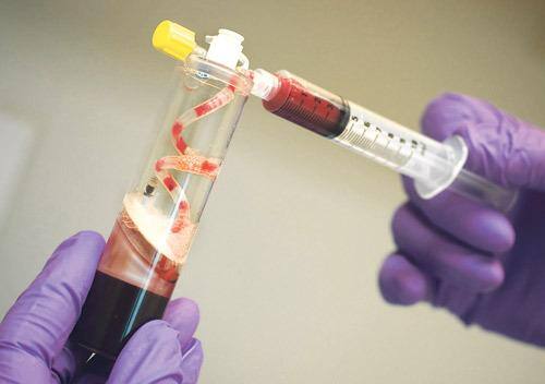 Plasma de sangue