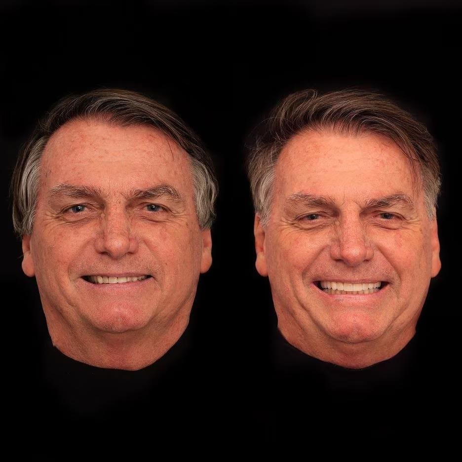 Bolsonaro faz harmonização