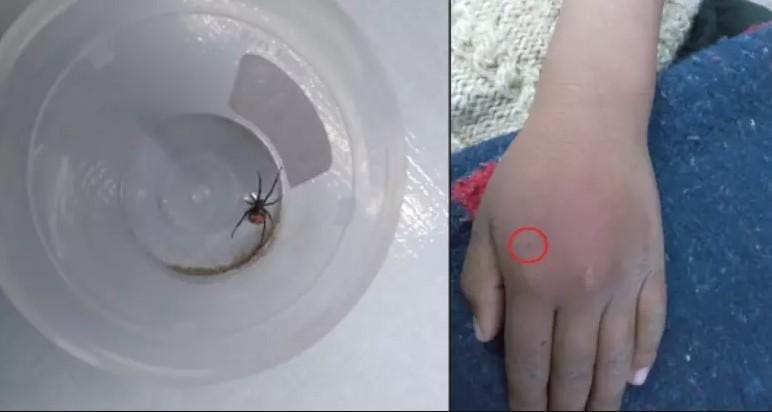 menino Bolívia picado aranha Homem-Aranha
