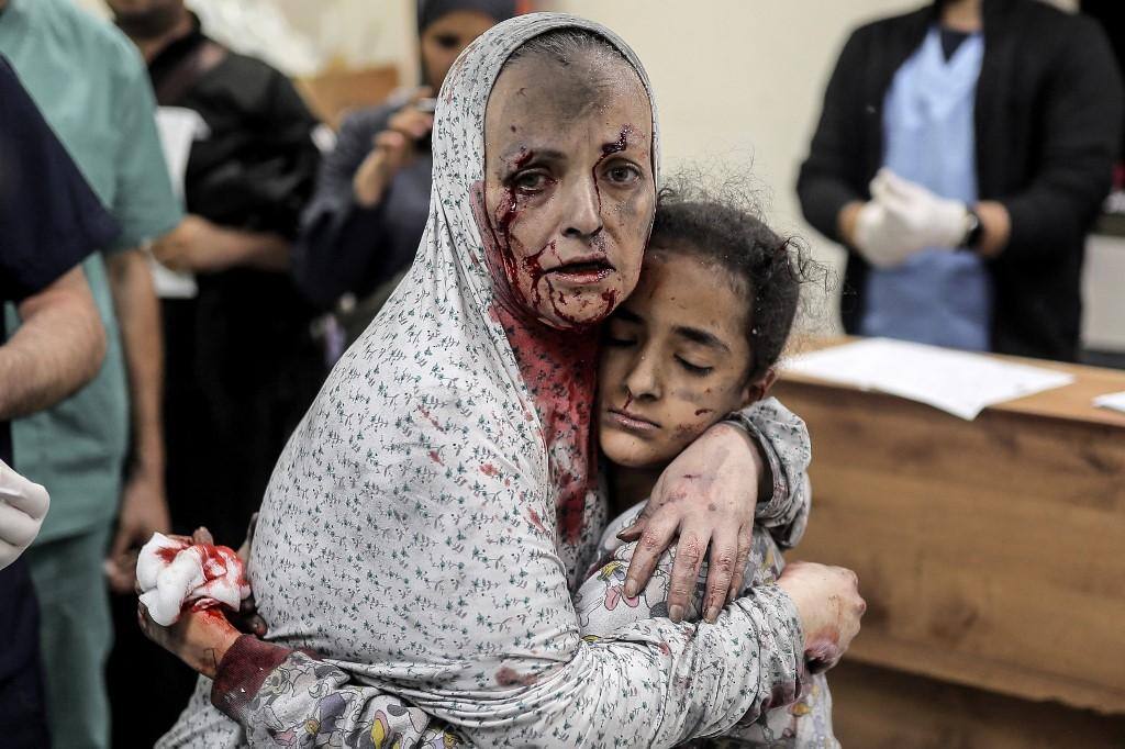 Mulher palestina ferida após bombardeio israelense em Gaza
