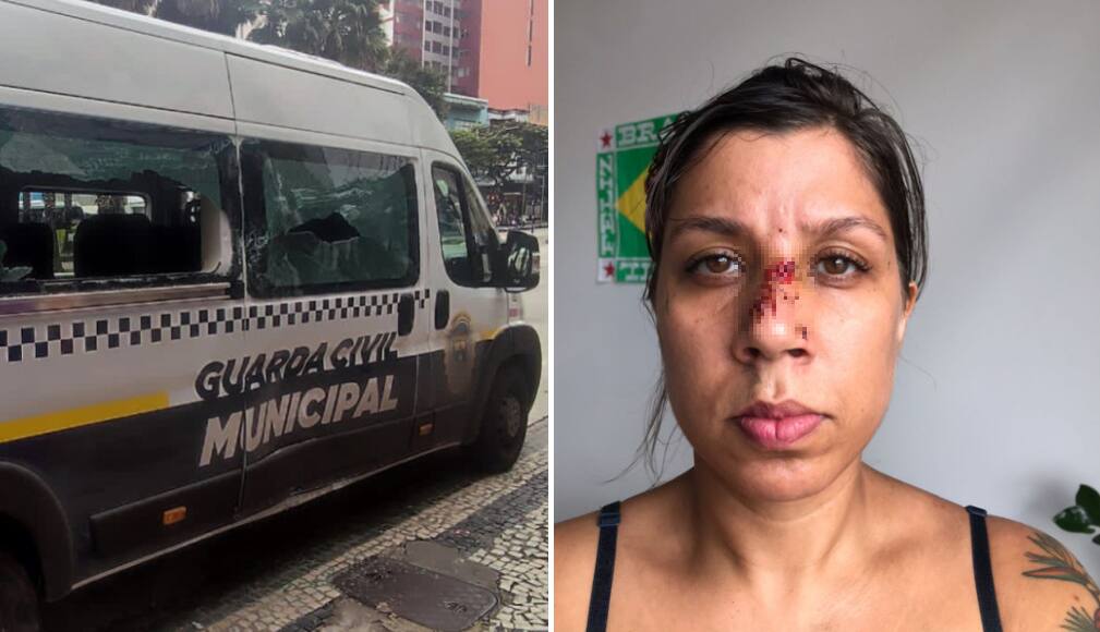 Marcela Viana afirma que ficará com cicatrizes por causa do acidente