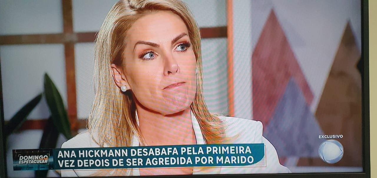 Ana Hickmann