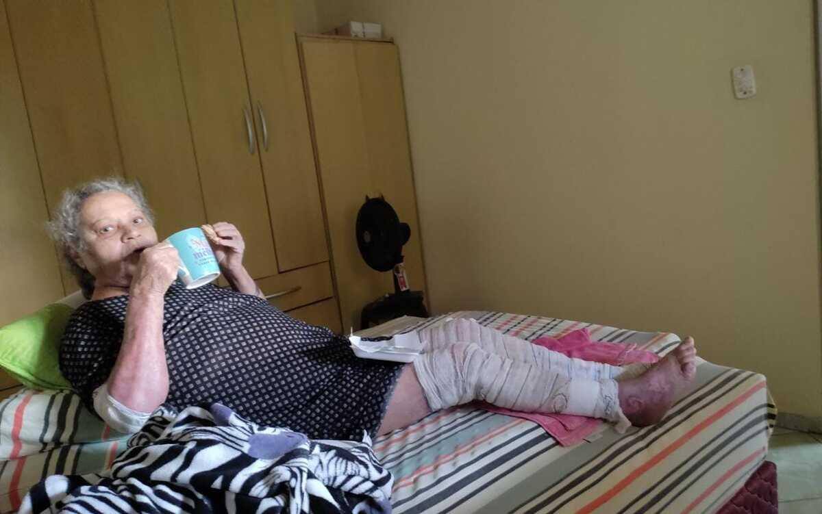 Dona Maria Auxiliadora segue tratando os ferimentos da queimadura e anemia