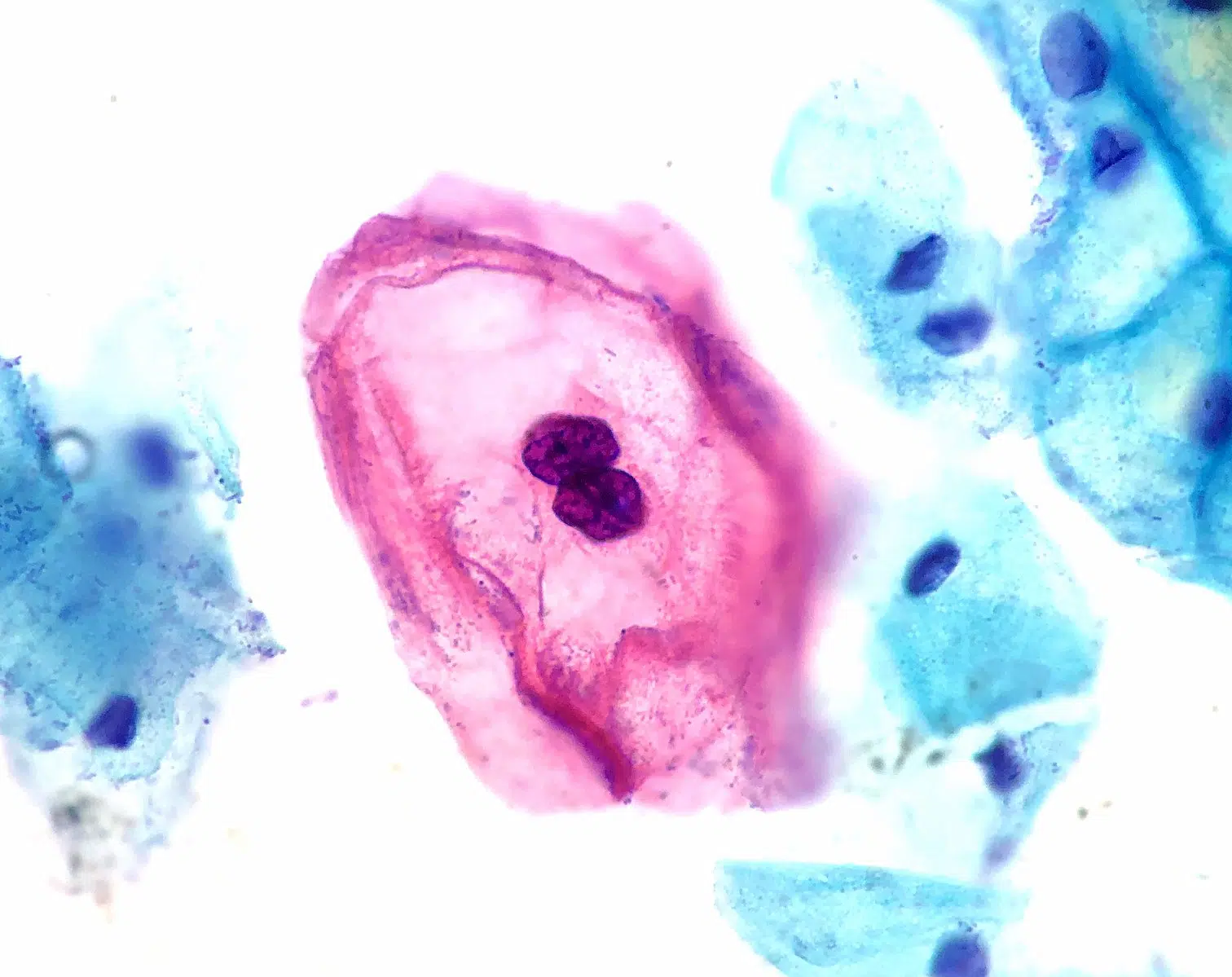 Microbiota vaginal alterada pode aumentar risco de clamídia e HPV, diz estudo