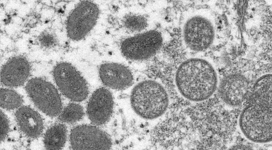 O vírus (monkeypox) pode ser transmitido do animal para o homem e vice-versa